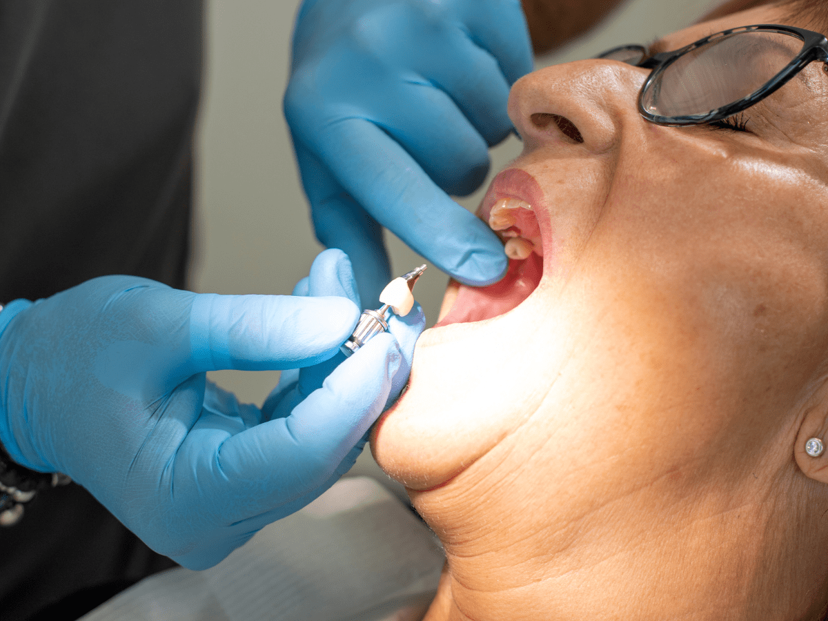 implanty zębowe w 24 godziny