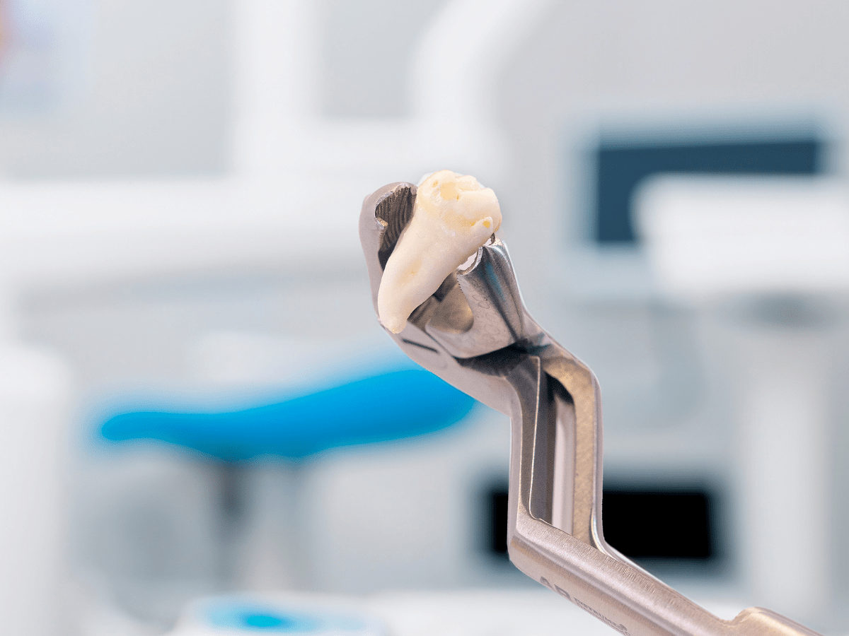 usuwanie zebów pod narkoza we wrocławiu